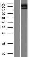 ADGRD2 / GPR144 Protein (Over-Expression Lysate Myc-DDK (Flag))