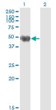PathPlus™ KRT20 / CK20 / Cytokeratin 20 Antibody (clone 2G3-1C8)