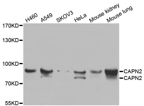 CAPN2 / Calpain 2 / M-Calpain Antibody (AP)