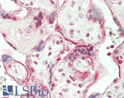 IHC-plus™ Polyclonal Rabbit anti-Human KDM7A / JHDM1D Antibody (aa290-316, IHC, WB)