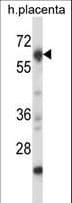 Polyclonal Rabbit anti-Mouse NRBP2 Antibody (aa454-482, IHC, WB)