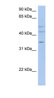 Polyclonal Rabbit anti-Human PXYLP1 / ACPL2 Antibody (aa71-120, WB)