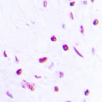 TP63 / p63 Antibody (phospho-Ser455)