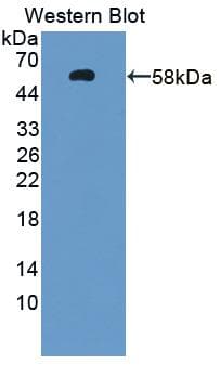 PEPD / PROLIDASE Antibody (aa2-493)