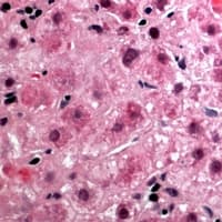 Polyclonal Rabbit anti-Human CEP131 / AZI1 Antibody (Internal, IHC, WB)