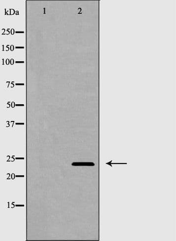 Polyclonal Rabbit anti-Human EDN1 / Endothelin 1 Antibody (IHC, WB)