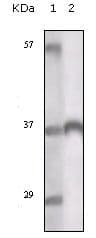 Monoclonal Mouse anti-Human TYRO3 Antibody (clone 1C10E8, 9A3F2, IF, WB)