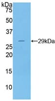 Human DNASE1 / DNase I Protein (Recombinant His, N-Terminal)