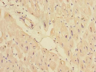 PPM1M Antibody