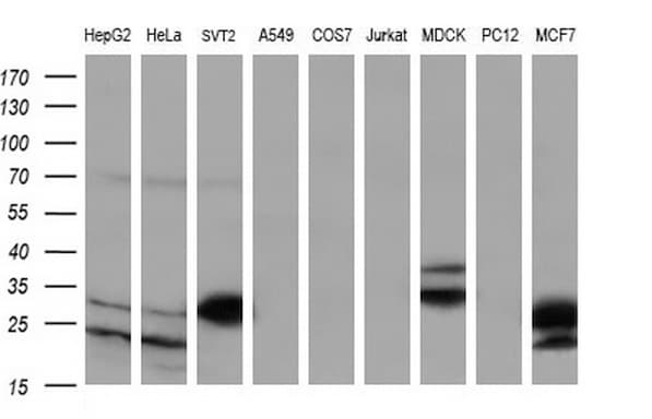 BCL2 / Bcl-2 Antibody (clone OTI2E5)