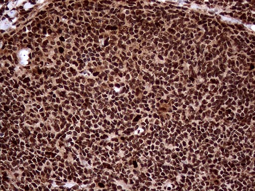 TALDO1 / Transaldolase 1 Antibody (clone OTI1E5, Carrier-free)