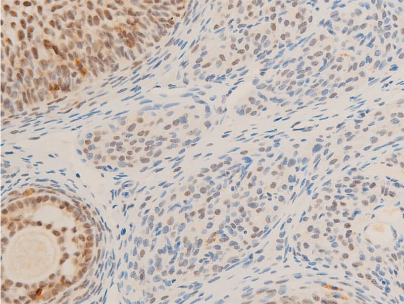 Polyclonal Rabbit anti-Human MYC / c-Myc Antibody (phospho-Ser62, IHC, IF, WB)