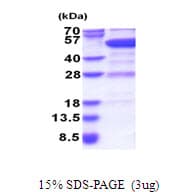 Human GDI2 Protein (Recombinant His)