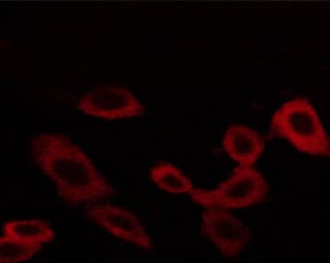 EGFR Antibody (phospho-Thr678)