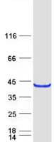 Human HORMAD2 Protein (Recombinant Myc-DDK (Flag))