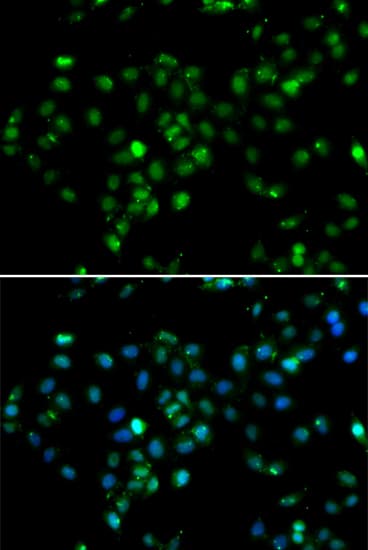 RBBP6 Antibody (aa1-118)