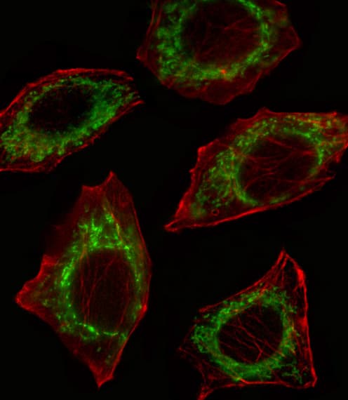 IHC-plus™ Polyclonal Rabbit anti-Human ALDH2 Antibody (aa52-81, IHC, IF, WB)