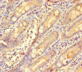 Polyclonal Rabbit anti-Human GCHFR Antibody (IHC, IF)