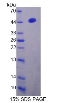 Human IRF2 Protein (Recombinant His-T7)