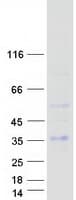 Human RGS20 / RGSZ1 Protein (Recombinant Myc-DDK (Flag))
