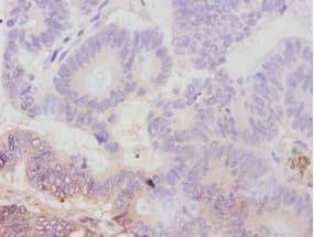 AVPR1A / V1a Receptor Antibody