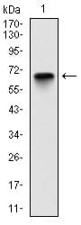 IHC-plus™ Monoclonal Mouse anti-Human G6PD Antibody (clone 2H7, IHC, WB)