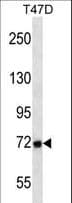 MMP2 Antibody (aa303-331)