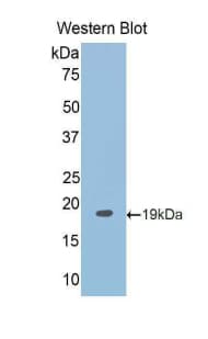 RBM20 Antibody (aa1089-1227)