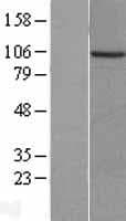PKN3 Protein (Over-Expression Lysate Myc-DDK (Flag))