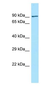FCHO2 Antibody (aa73-122)