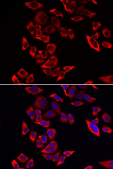 RPL9 / Ribosomal Protein L9 Antibody