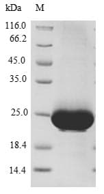 Human RAB4A / RAB4 Protein (Recombinant GST, N-terminus)
