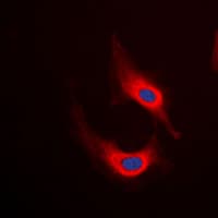 DES / Desmin Antibody (C-Terminus)