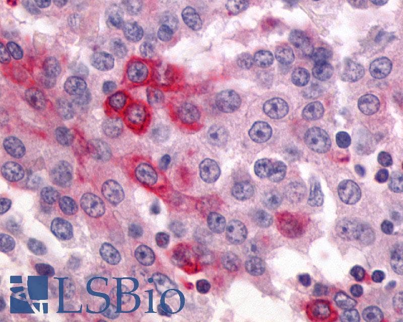 PathPlus™ ADGRG2 / GPR64 Antibody (C-Terminus)