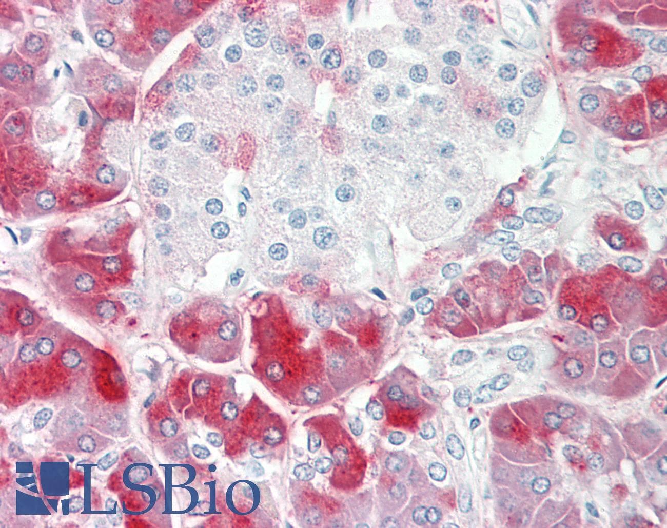 Polyclonal Rabbit anti-Human PRSS3 / Trypsin 3 Antibody (aa71-120, IHC, WB)