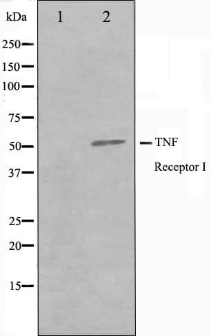 TNFRSF1A / TNFR1 Antibody