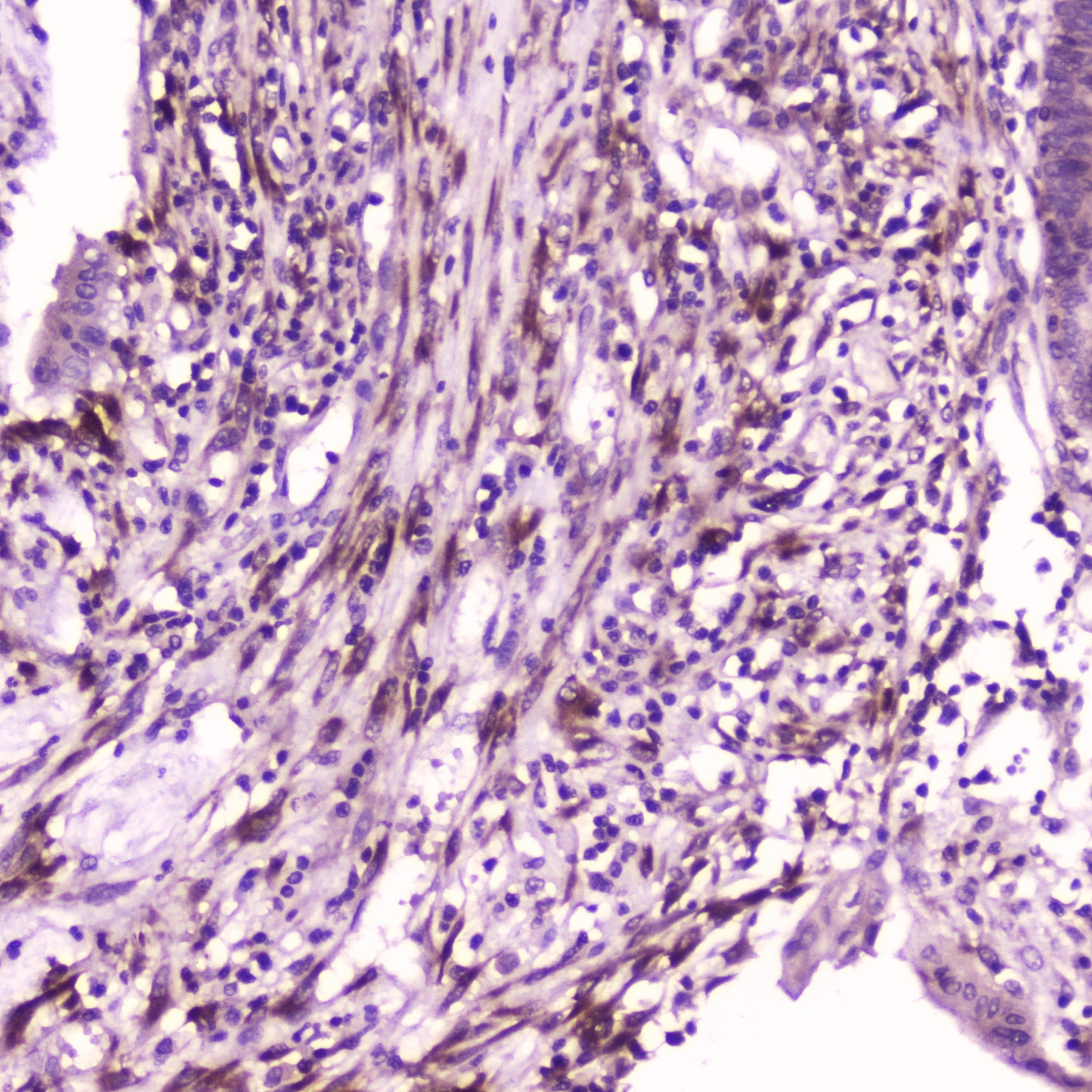 IL36A Antibody