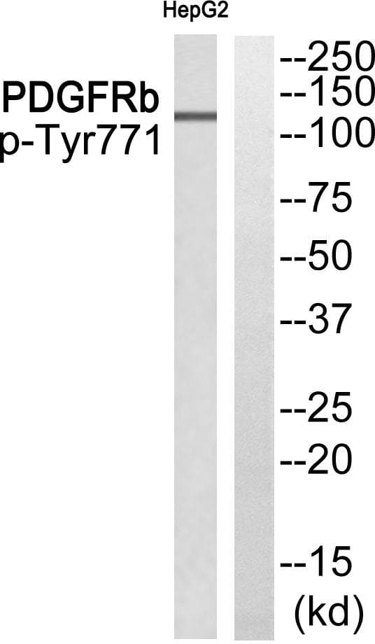 EPS15 Antibody (phospho-Tyr849)