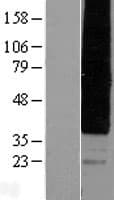 HCAR2 / NIACR1 Protein (Over-Expression Lysate Myc-DDK (Flag))