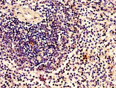 ZBTB8OS Antibody