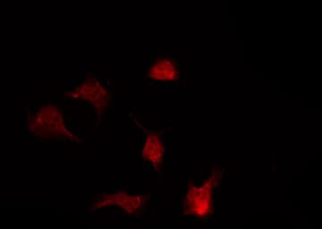 Polyclonal Rabbit anti-Human ABL1 / c-ABL Antibody (phospho-Tyr204, IF, WB)