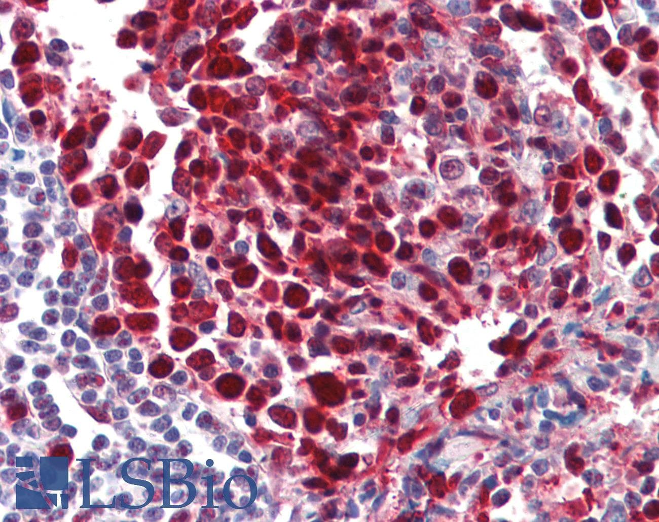 IHC-plus™ PCNA Antibody (clone PC10)