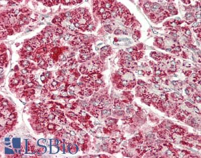 IHC-plus™ Polyclonal Rabbit anti-Human HADHB Antibody (IHC, IF, WB)