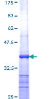 Human ANAPC1 / APC1 Protein (Recombinant GST, N-terminus)