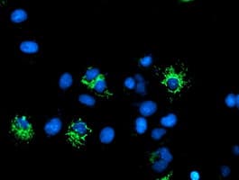 DLD / Diaphorase / E3 Antibody (clone OTI4E11)