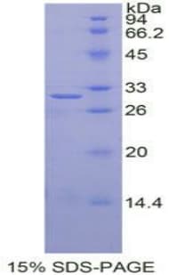 Human IGF2BP2 Protein (Recombinant His-T7)