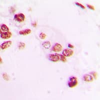 NR1A2 / THRB Antibody (N-Terminus)