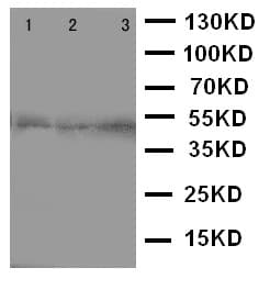 CCR9 / CD199 Antibody (aa1-17)