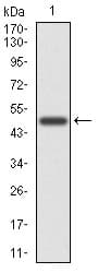 CD6 Antibody (clone 6B9)