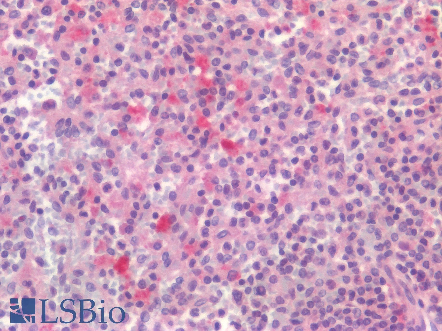 IHC-plus™ CD4 Antibody (Extracellular Domain)